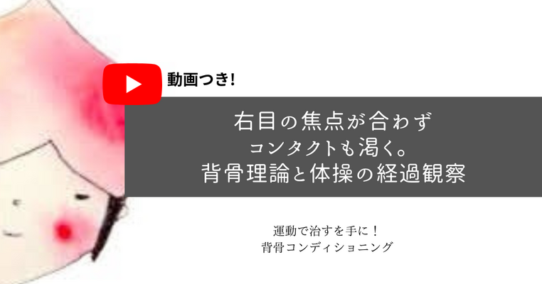 ＜動画つき＞右目の焦点が合わずコンタクトも渇く。背骨理論と体操の経過観察